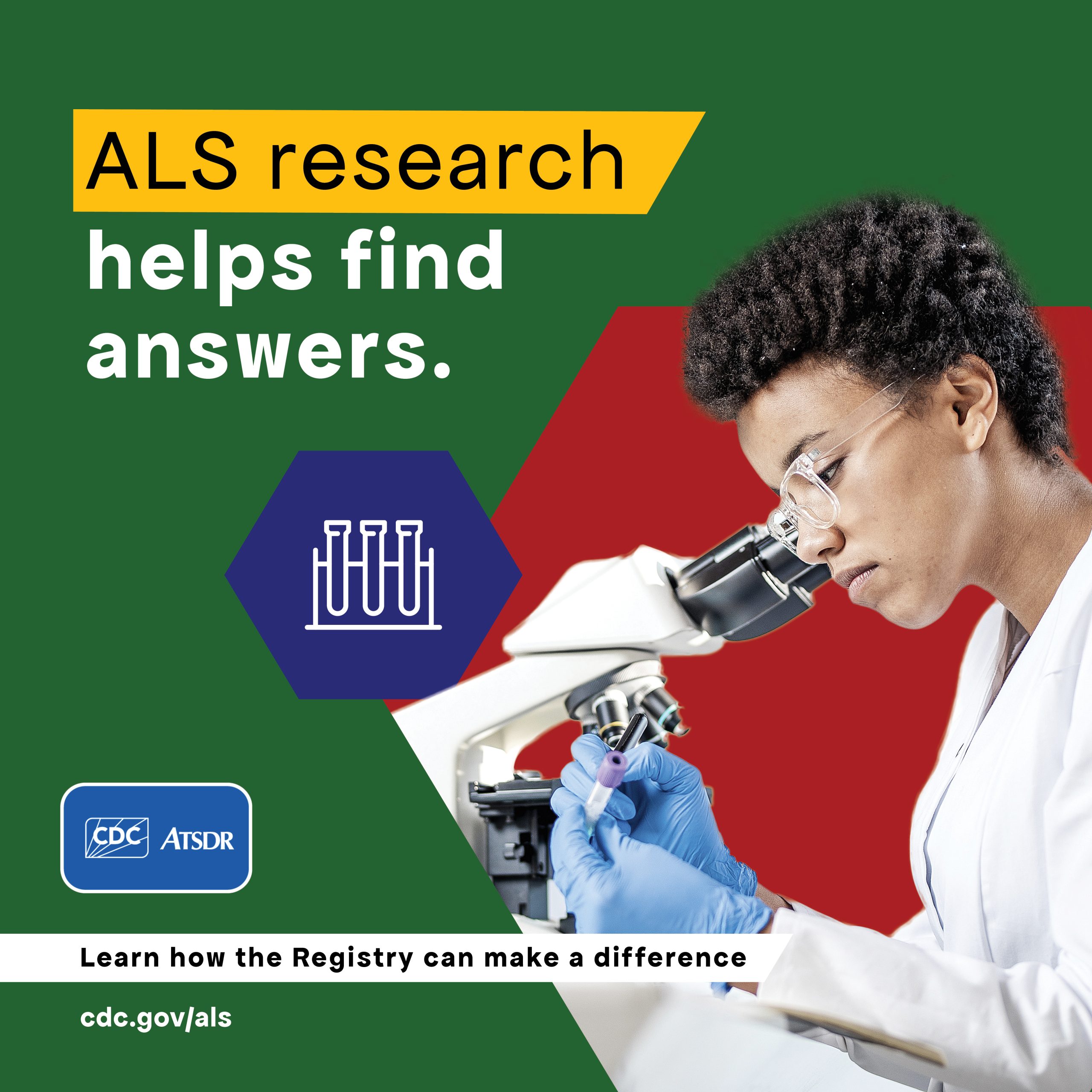 Research-1 ALS Research helps find answers