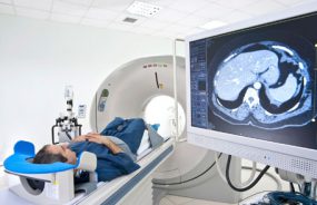 A man on a CAT scan table with an image of his brain on a monitor.